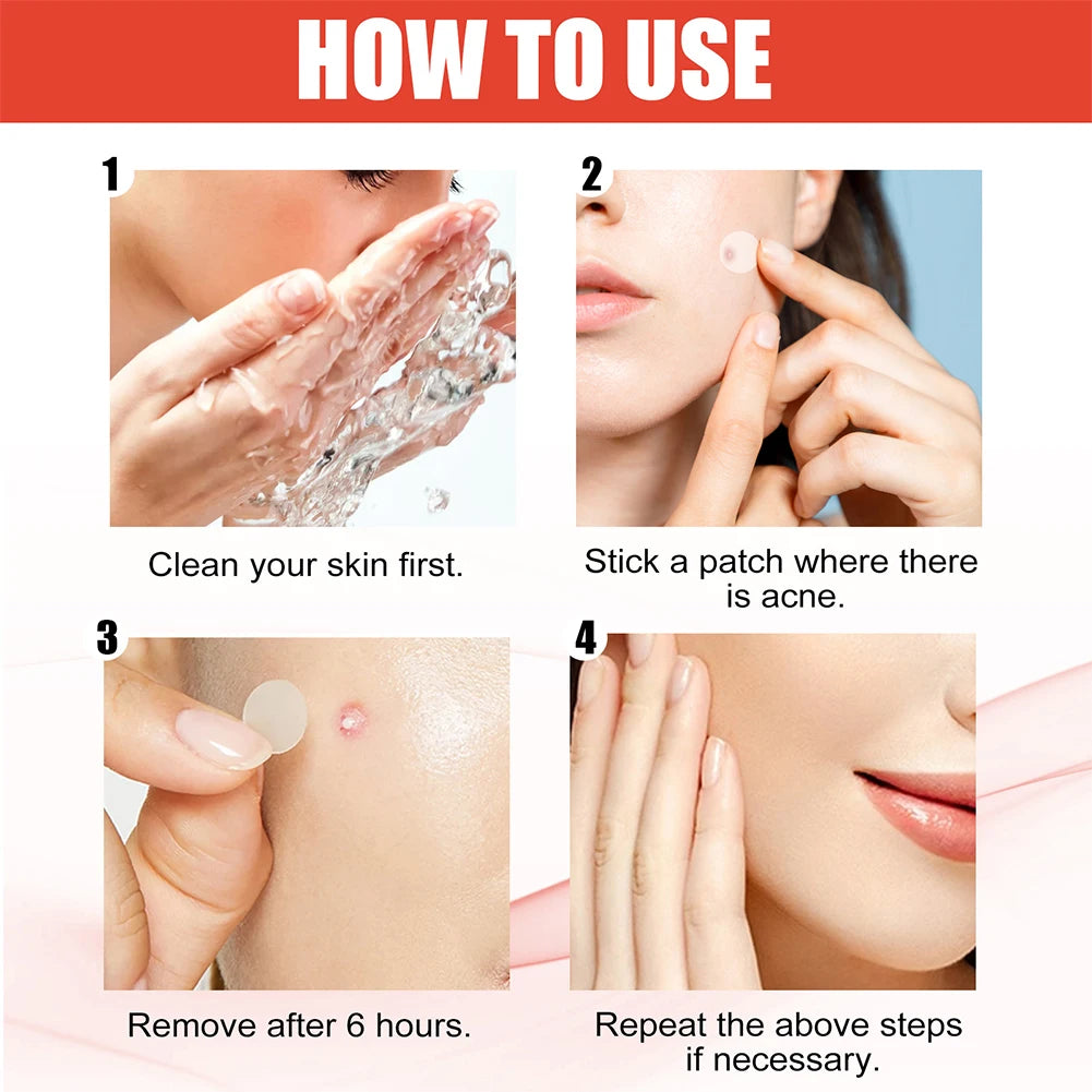 Acne Pimple Patch