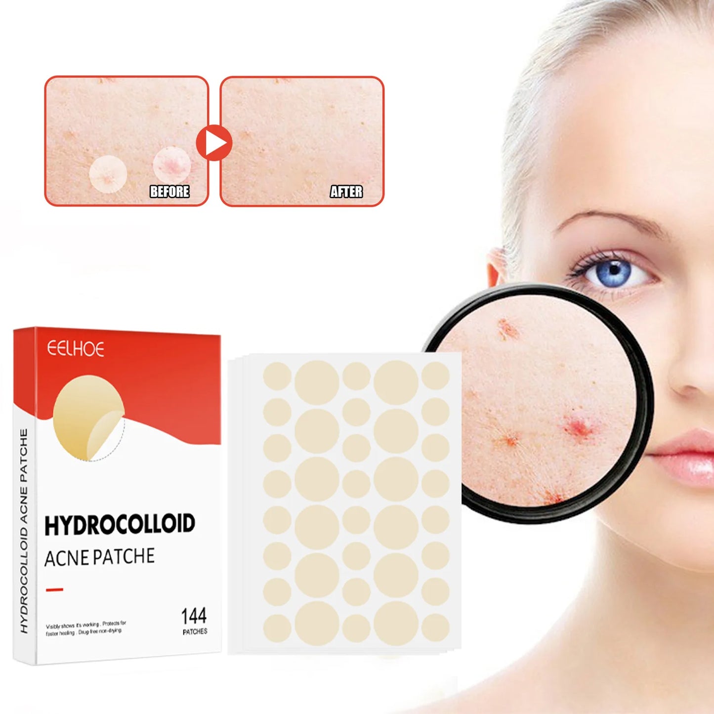 Acne Pimple Patch